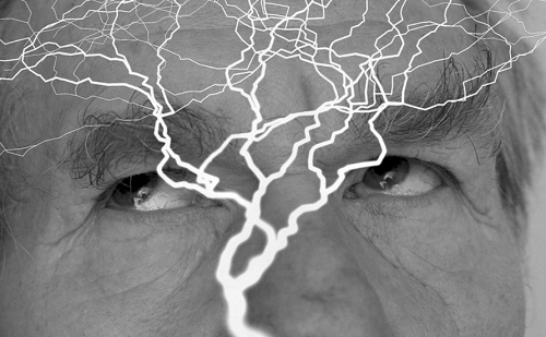 Döbbenetes pontosság - Mesterséges intelligencia-fejhallgató jelez előre epilepsziás rohamot
